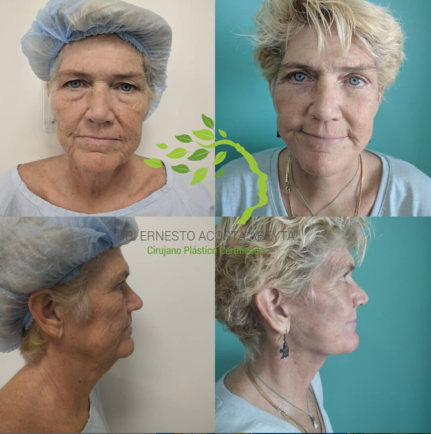 Clinic Results Gallery